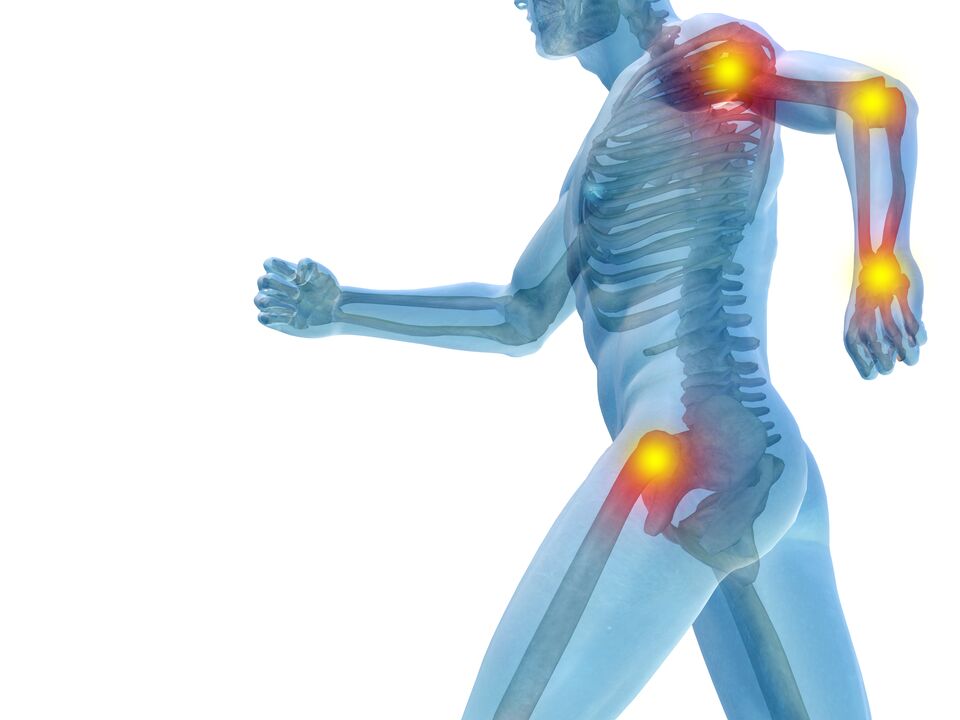 Inflamación de las articulaciones y tratamiento con gel Artovitel.